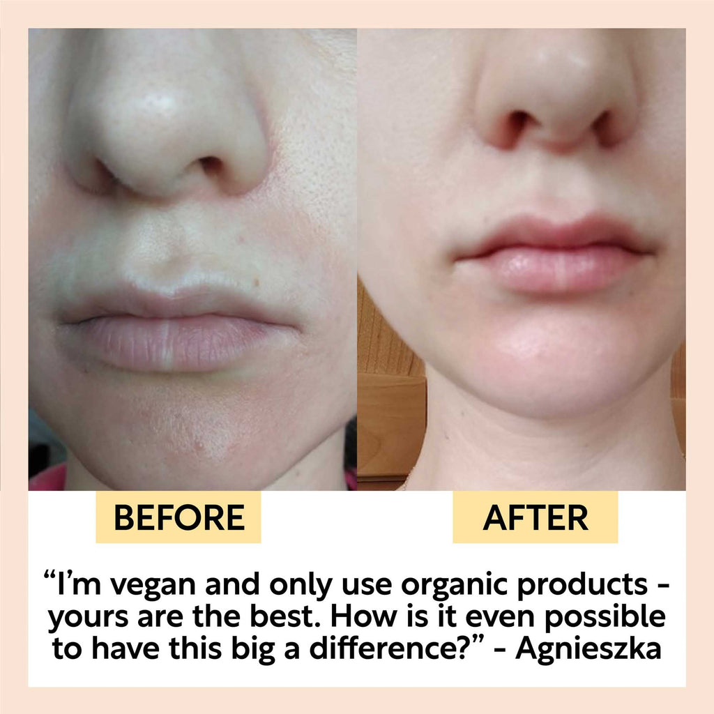 Hydration Skincare Set